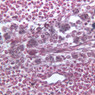 A34, Lymph Node, 40x (Reticulin)