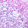 A35, Lymph Node, 40x (H&E)