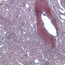 A37, Spleen, 10x (Reticulin)