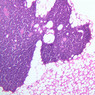 A43, Thymus (Adult), 10x (H&E)