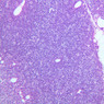 A44, Thymus (Infant), 20x (H&E)