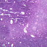 A44, Thymus (Infant), 10x (H&E)