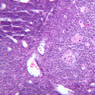 A44, Thymus (Infant), 20x (H&E)