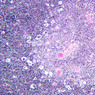 A45, Thymus (Infant), 10x (H&E)
