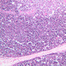 A45, Thymus (Infant), 10x (H&E)