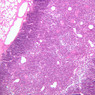 A46, Thymus (Adolescent), 10x (H&E)