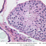 B81, Testis, 40x Labeled (PAS)