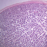 B81, Testis, 1x (PAS)