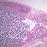 B81, Testis, 1x (PAS)
