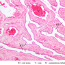 B79, Testis (Rete Testis), 10x Labeled (H&E)