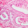 B79, Testis (Tubuli Recti), 40x (H&E)