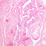 B79, Testis (Rete Testis), 10x (H&E)