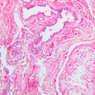 B79, Testis (Rete Testis), 20x (H&E)