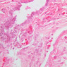 B79, Testis (Rete Testis), 40x (H&E)