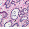B81, Testis (Efferent Ductules), 20x Labeled (PAS)