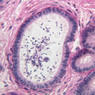 B81, Testis (Efferent Ductules), 40x (PAS)