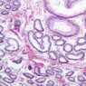 B81, Testis (Tubuli Recti), 10x (PAS)