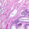 B81, Testis (Efferent Ductules), 10x Labeled (PAS)