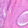 B80, Epididymis (Tail), 10x (H&E)