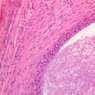 B80, Epididymis (Tail), 20x (H&E)