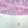 B81, Epididymis, 2.5x (PAS)