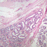 B81, Epididymis, 2.5x (PAS)