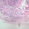 B81, Epididymis, 2.5x (PAS)