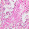 B90, Prostate, 20x (H&E)
