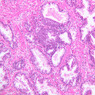 B91, Prostate, 10x (H&E)