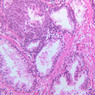 B91, Prostate, 20x (H&E)