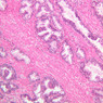 B91, Prostate, 10x (H&E)