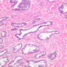 B92, Prostate (Prepubertal), 10x (H&E)