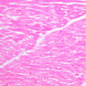 A25, Left Ventricle (Cardiac Muscle), 20x (H&E)