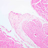 A25, Purkinje Fibers (Cardiac Muscle), 10x (H&E)