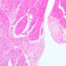 A25, Purkinje Fibers (Cardiac Muscle), 10x (H&E)