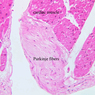 A25, Purkinje Fibers (Cardiac Muscle), 20x Labeled (H&E)