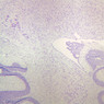 A79, Choroid Plexus, 2.5x (CV)