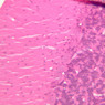 Neural Tissue