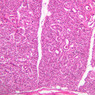 B47, Parotid Gland, 10x (H&E)