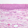 A67, Epiglottis (Pharyngeal Surface), 20x (H&E)
