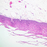 A68, Soft Palate (Lingual Surface), 10x (H&E)