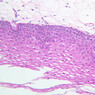 A68, Soft Palate (Lingual Surface), 20x (H&E)