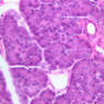 B36, Pancreas, 40x (H&E)