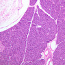 B36, Pancreas, 10x (H&E)