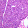 B36, Pancreas, 20x (H&E)