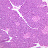 B36, Pancreas, 10x (H&E)