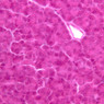 B36, Pancreas, 40x (H&E)