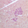 B37, Pancreas, 20x (AF)
