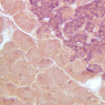 B37, Pancreas, 40x (AF)