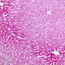 B31, Liver, 10x (PAS)